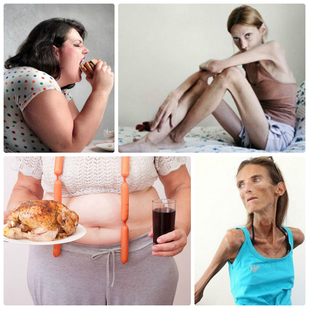 Психология расстройств пищевого поведения22
